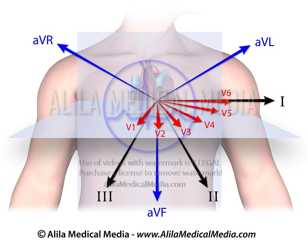 12-lead ECG